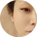 압구정-217 | 압구정 피부관리 모르면 손해 꽁쌤에스테틱 물방울리프팅 후기