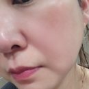 엔알디 | 건조하고 예민한 피부에도 사용할 수 있는 엔알디 필링젤
