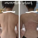 김영애피부관리실 | 70대 여성 고객님 단 10회 관리 후 체형이 달라진 이유