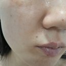 성복약국 | 약국전용 K스킨케어 쥬비렉스 올리고 PDRN 크림후기