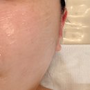 수양로 | 거제에스테틱 수월 더윤뷰티 :: 수기윤곽관리 후기