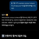 굿비뇨기과 - 양평군 시민로 37 | P03 : 아내의 산전검사 결과 및 남편의 e 보건소 산전검사 후기