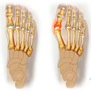 엄지초장 이미지