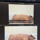 삼정한의원 | 부산 서면 웨딩관리 / 효과좋은 승모근관리 등관리 신부관리 전문 에스테틱 더유에스테틱(THEYOU)