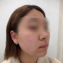 수청동] 아름다온뷰티오산본점 오산피부관리 오산마사지 오산속눈썹 오산네일 오산대역피부관리 하이푸