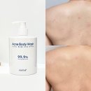 P-6919 | 등드름 바디워시 구스투스 아크네 여드름 바하 바디워시 사용후기