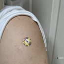 이정희소아과의원 | 얀더나 진화 완료 : 얀센 부스터샷 모더나 추가 접종 후기