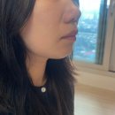 콜라당 | 의정부피부관리 모공 스킨부스터 포텐자 콜라스터 2회차 후기