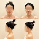 놀면뭐하니 발마사지 위뷰티 용산점 얼굴경락 리프팅 후기