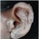 힐링뷰티피부 이미지