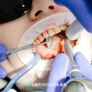 임플란티아치과의원 충주점 네이버블로그