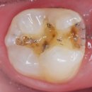 설 치과기공소 이미지