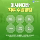 치루개 이미지