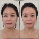 정관이지더원2차여자경로당 | 정관 통증관리·정관 비대칭 관리 잘하는 곳, 썬플 에스테틱에서 친구와 함께 경험한 놀라운 변화