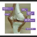 관절경수술잘하는곳 강서구입니다. 이미지