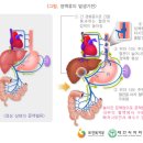 간암의 재발과 전이의 예측 이미지