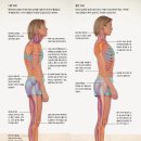 바른자세 테라피 이미지