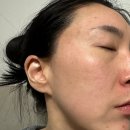 루비스킨케어 - 평택시 안정로 52-12 | 미백크림 추천 메라블 루비알엔 피코샷 크림 색소침착 케어 후기