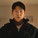토닥토닥약국 | W11. 내돈내산 이마필러 시술 후기 (추천, 붓기, 효과, 웨딩촬영 시기 등)