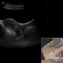 .3D How To: Female Pelvis Ultrasound Exam - SonoSite Ultrasound . 이미지
