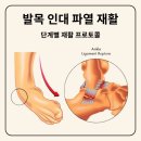 저항운동연구소(Weight Training Lab) | 발목 인대 파열 후 단계별 재활 프로그램 2단계: 근력 강화 운동