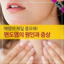 예방이 제일 중요해! 편도염의 원인과 증상 이미지