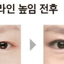 라인톡톡 중앙일보
