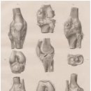 종로광장정형외과의원 | 무릎 건강을 지키는 효과적인 런닝 자세와 식단 전략