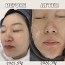 조하일 | 학익동 피부관리샵 조하뷰티 1년 찐관리후기 내돈내산!