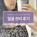 미인본가 | 부평 옆광대축소 작은얼굴관리 추천 미인본가 후기