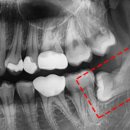 이하루치과의원 이미지