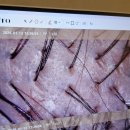 리포즈에스테틱 | 대구 두피관리 맛집 리포즈에스테틱 탈모케어 후기