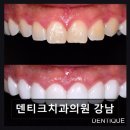 이모든치과의원 | [강남 임플란트 치과/추천/후기] 덴티크치과의원 강남 환자 중심 케어로 신뢰 쌓다
