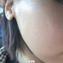 CU 분당구미점 | 분당 구미동피부관리 잘하는 올가드림뷰티 분당구미점 비타민리프팅 후기