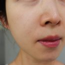 [피부재생 스킨부스터 셀르디엠 3회차 후기, 효과] 리투오랑 뭐가 다를까 + 피쓰 화장품 구매