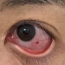 양산성모안과의원 이미지