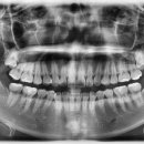 서울청춘치과의원 이미지