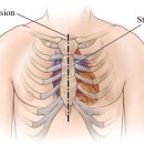 가슴뼈통증과 스트레스 [천안 나래한의원] 이미지