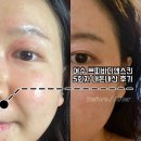 제5회 여수음악제 | 여수 쁘띠바디앤스킨｜속건조, 모공, 피부결 개선 내돈내산 5회차 경험담!
