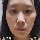 아름턱한의원 이미지