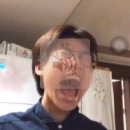 [종로] 세란통마취통증의학과의원 겨드랑이 다한증 치료 및 보톡스 (겨땀, 예약, 실비 청구 후기)