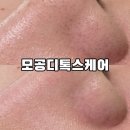 시나브로뷰티샵(sinabro) | 대구 모공관리 후기｜두류동 룩앳더뷰티 모공 디톡스 케어