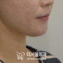 화창정밀 이미지