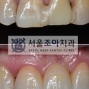 서울조아치과 이미지