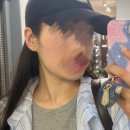 갤러리아진주프로젝트엠 | 진주피부관리 엘트리움스킨앤바디 녹는실 스타리프팅 윤곽 관리 받은 후기