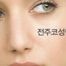 이명철성형외과 이미지