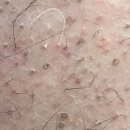 소풍경 서구구덕운동장점 | 왁싱 효과 오래가게 하는 방법 ✨ 시술 전·후 관리법 동대신 왁싱 스킨갤러리