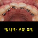 단대오거리 1번출구 앞 이미지