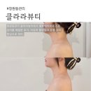 세븐테라피 | 창원 등관리 클라라뷰티 뱀부테라피 후기｜창원피부관리 프라이빗 힐링 공간