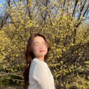 강남 내돈내산 필러 후기 (이마필러+입술필러)
